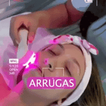 Skinglow pro radiofrecuencia